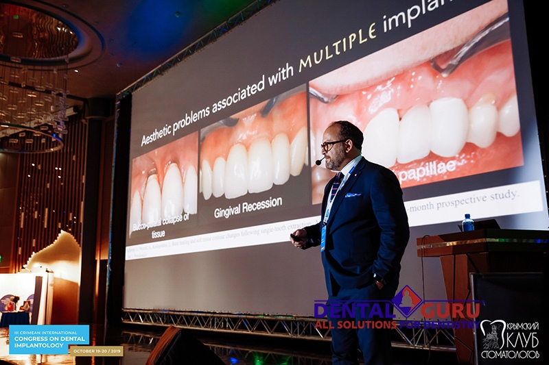 19-20 октября 2019. III Международный имплантологический конгресс в Ялте