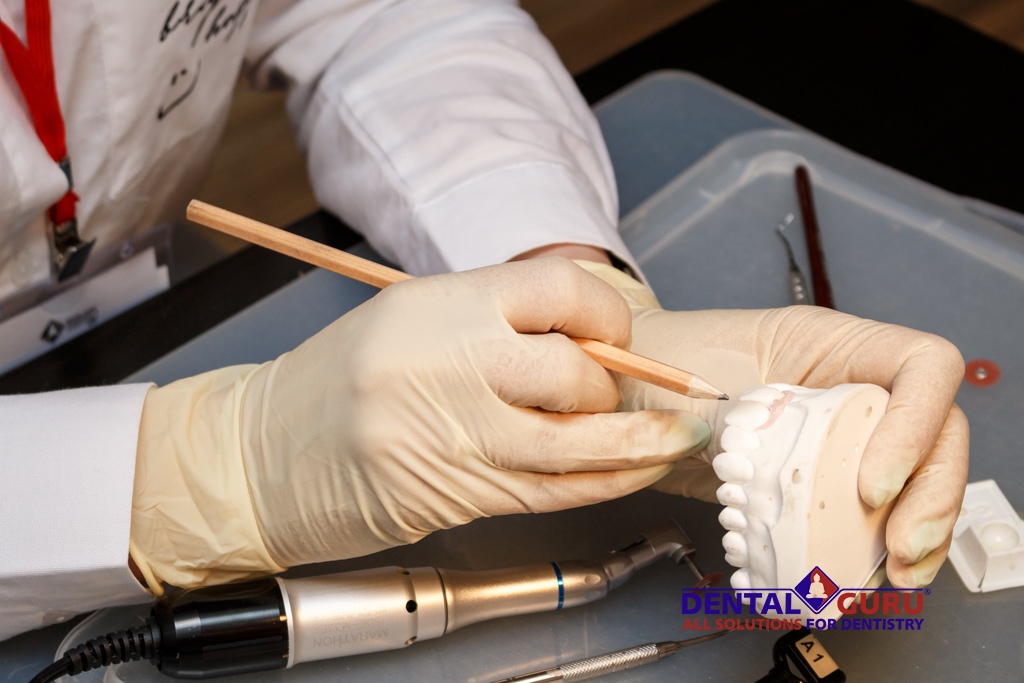 Секреты идеальной реставрации