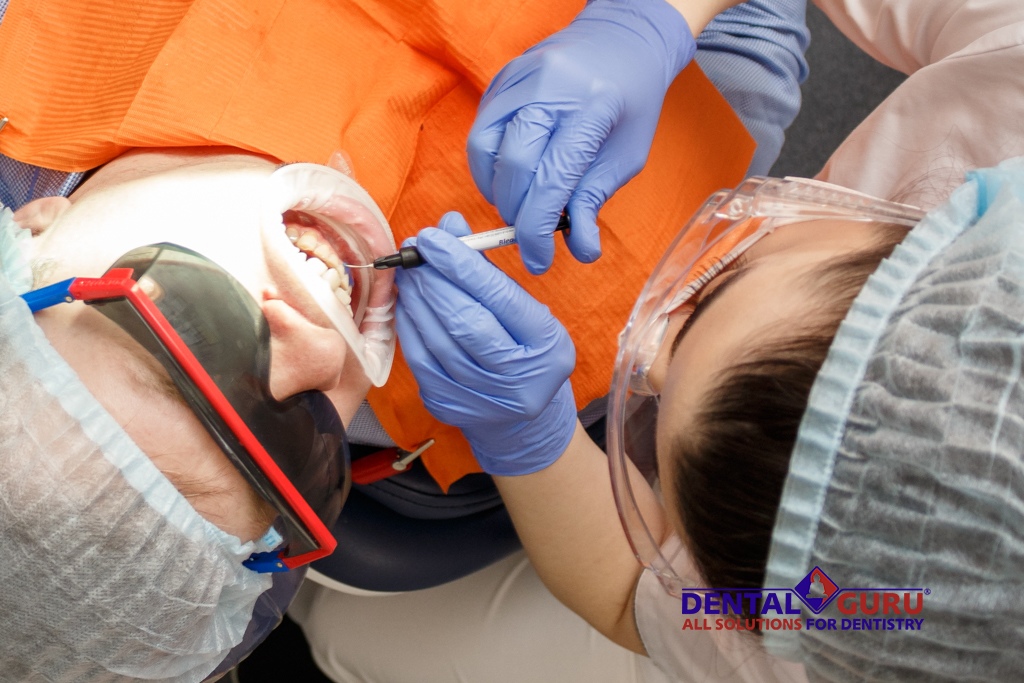 Первый московский чемпионат по отбеливанию в клинике «Дентал Гуру»