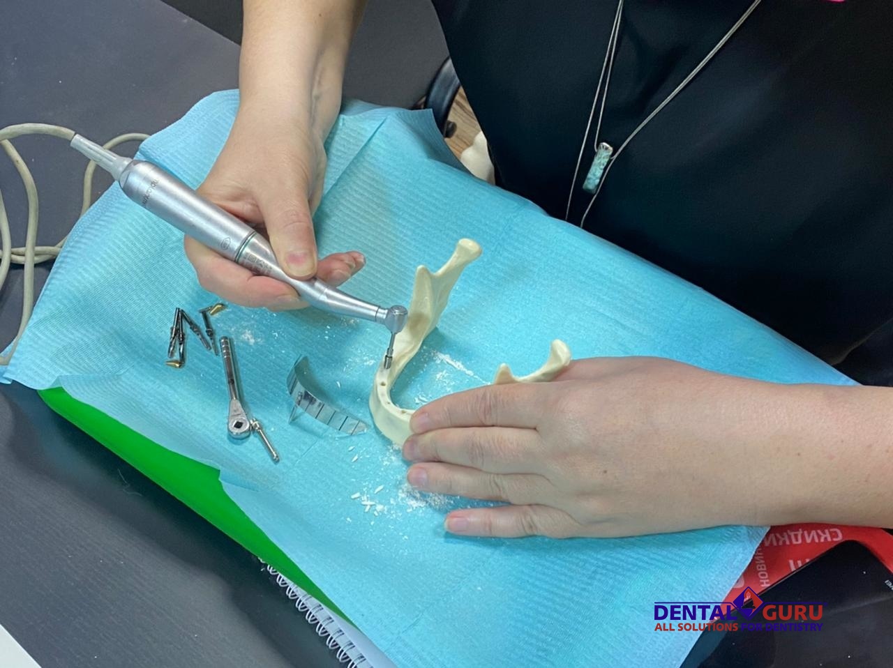 «Стоматологическая реабилитация с помощью ангулированных имплантатов. Имплантация на 4-х имплантатах. Физиологическое и анатомическое обоснование». Пост-релиз 31.01.21