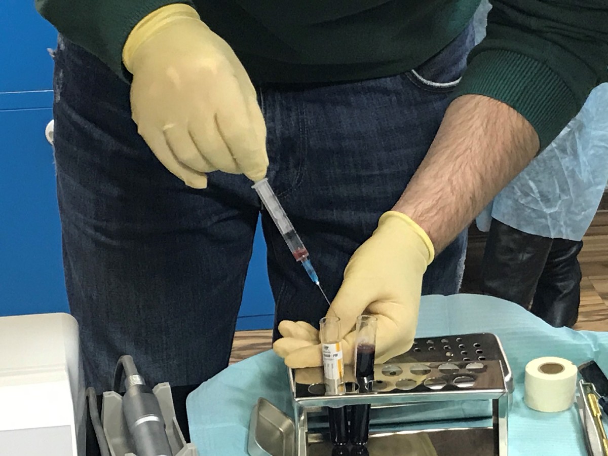 Плазмотерапия PRF в стоматологии. 9 февраля 2020. Сечко Нина Андреевна