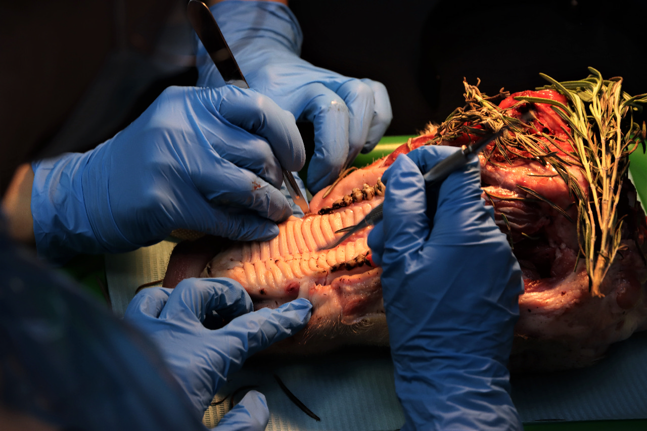 Атравматичное удаление зубов и методики наложения швов