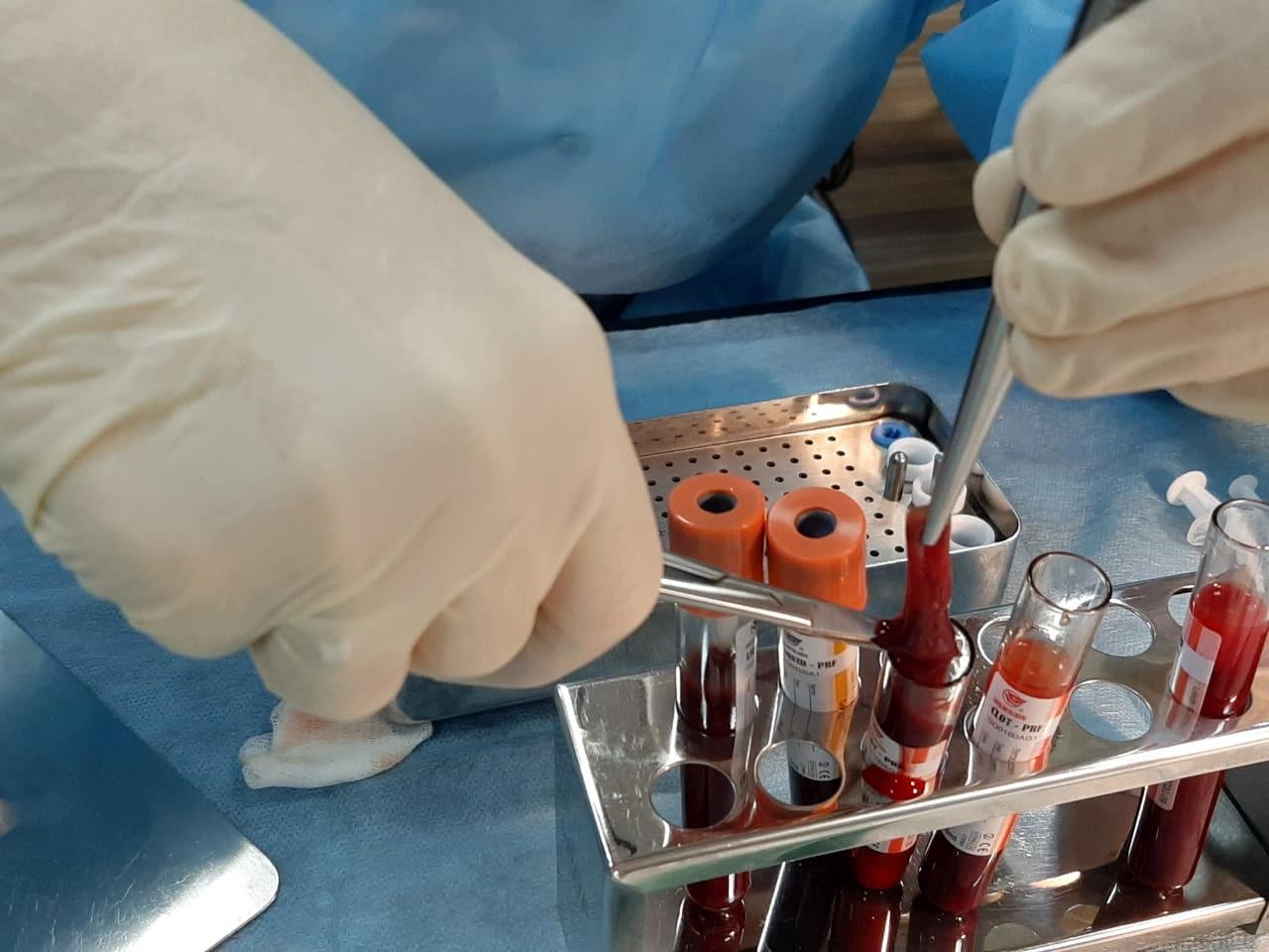 Плазмотерапия PRF в стоматологии. Курс в УЦ Дентал Гуру 3 сентября.