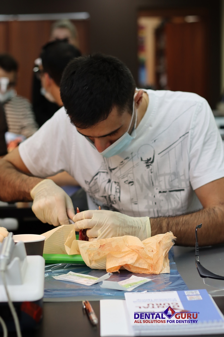 Атравматичное удаление зубов и методики наложения швов. Пост-релиз 3 августа 2021