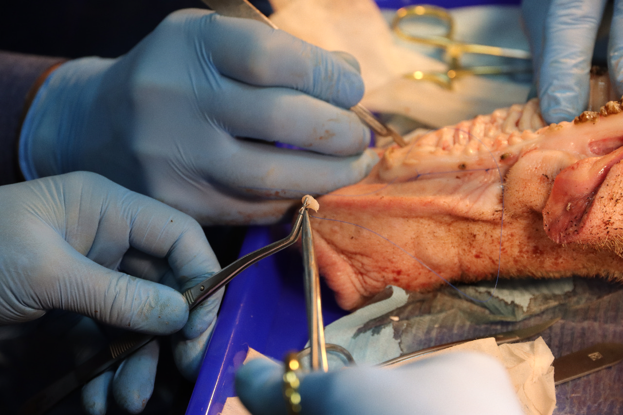 Пластика мягких тканей вокруг имплантатов. Морфологический подход