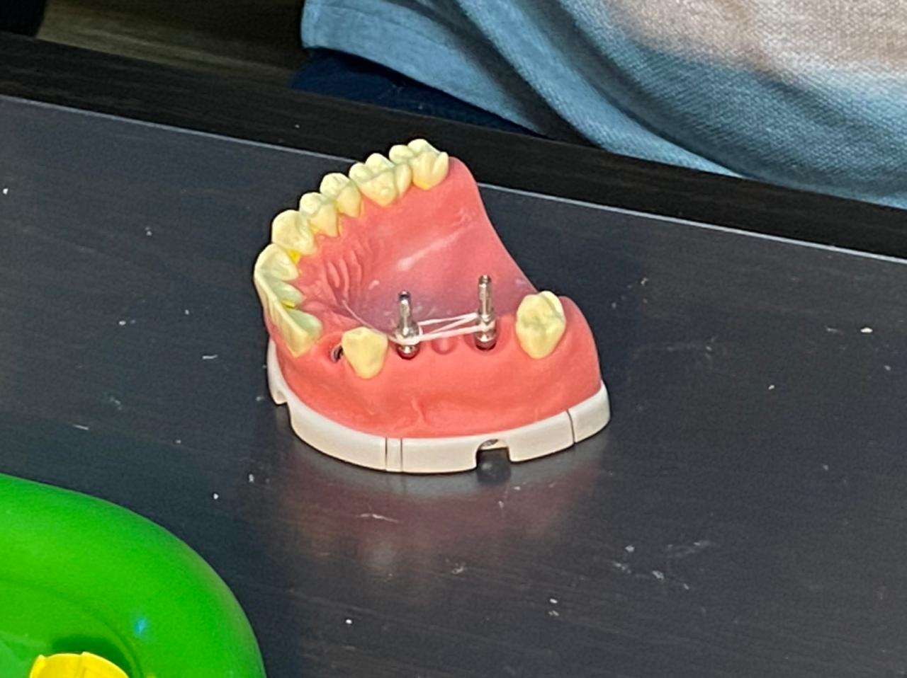 Базовый курс по имплантации. Пост-релиз 27-28 февраля