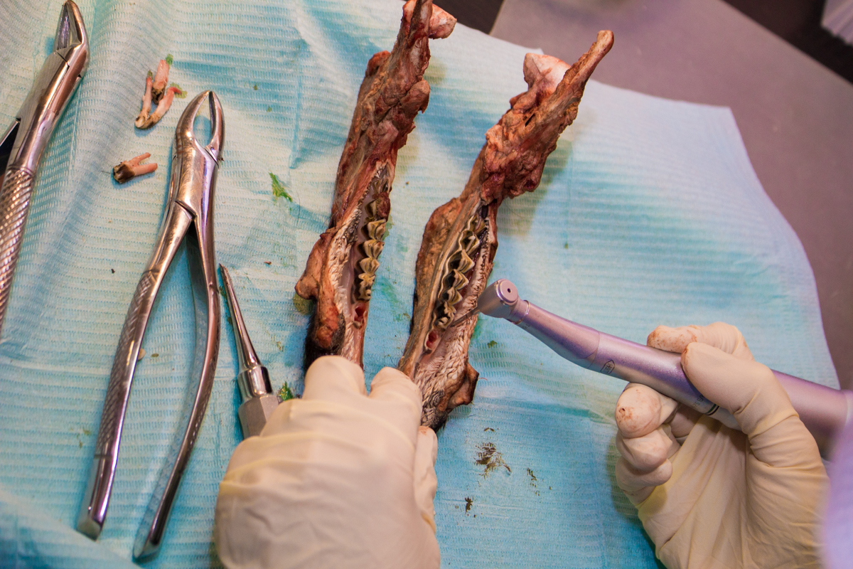 Одномоментная имплантация и немедленная нагрузка. 3 февраля 2020