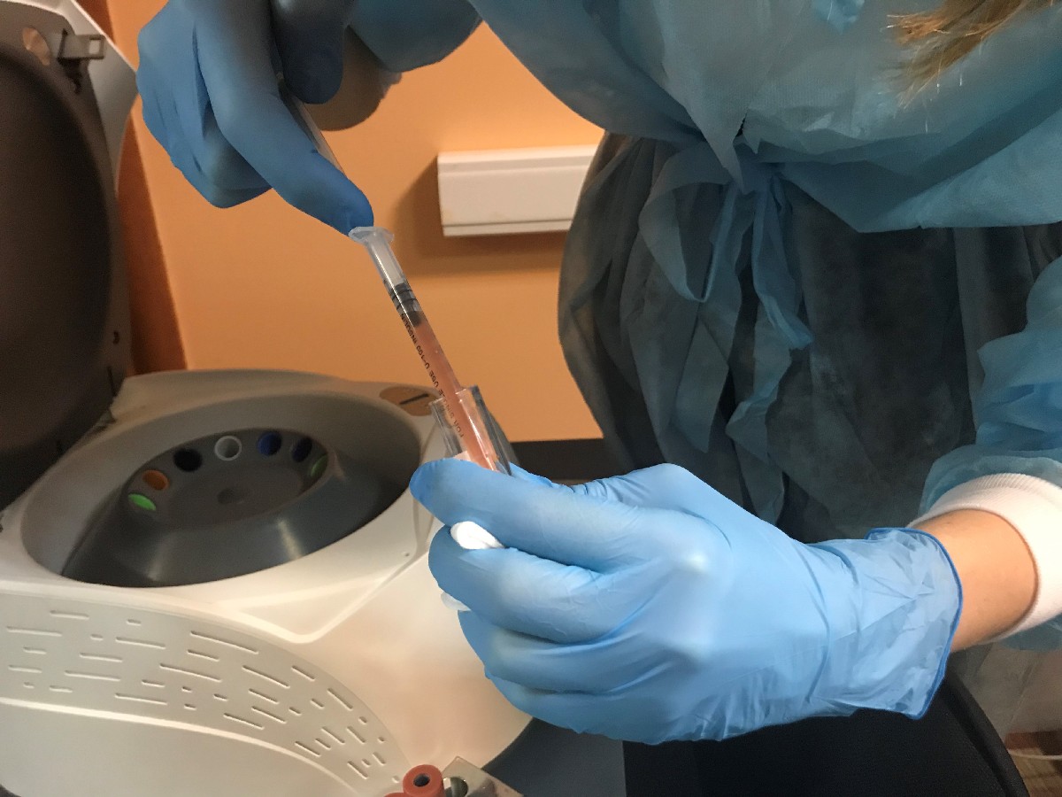 Применение плазмы с высоким содержанием фибрина (IPRF) в эстетической медицине.  17 ноября  2019. Сечко Нина Андреевна