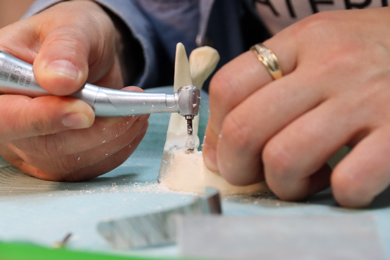 Стоматологическая реабилитация с помощью ангулированных имплантатов