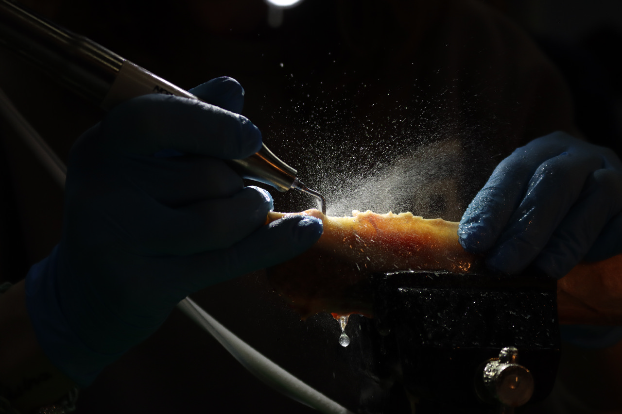 Продвинутый курс по имплантации: костная пластика и синус-лифтинг