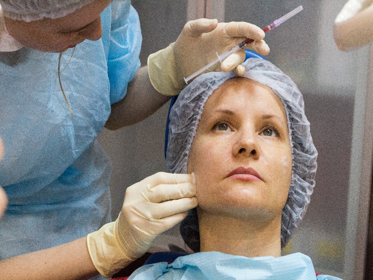 Применение плазмы с высоким содержанием фибрина (IPRF) в эстетической медицине