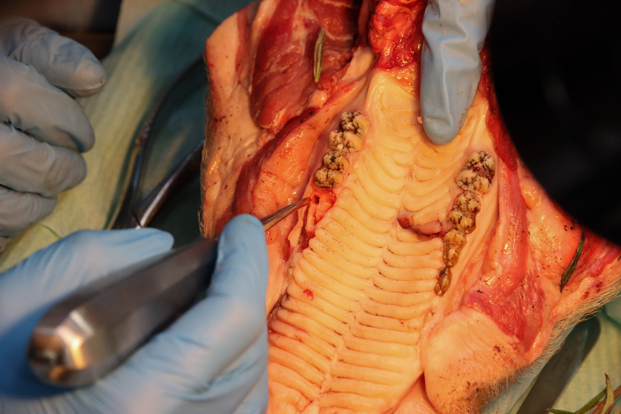 Атравматичное удаление зубов и методики наложения швов