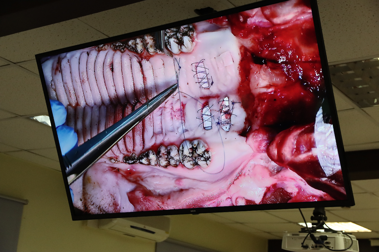 Продвинутый курс по пластике мягких тканей