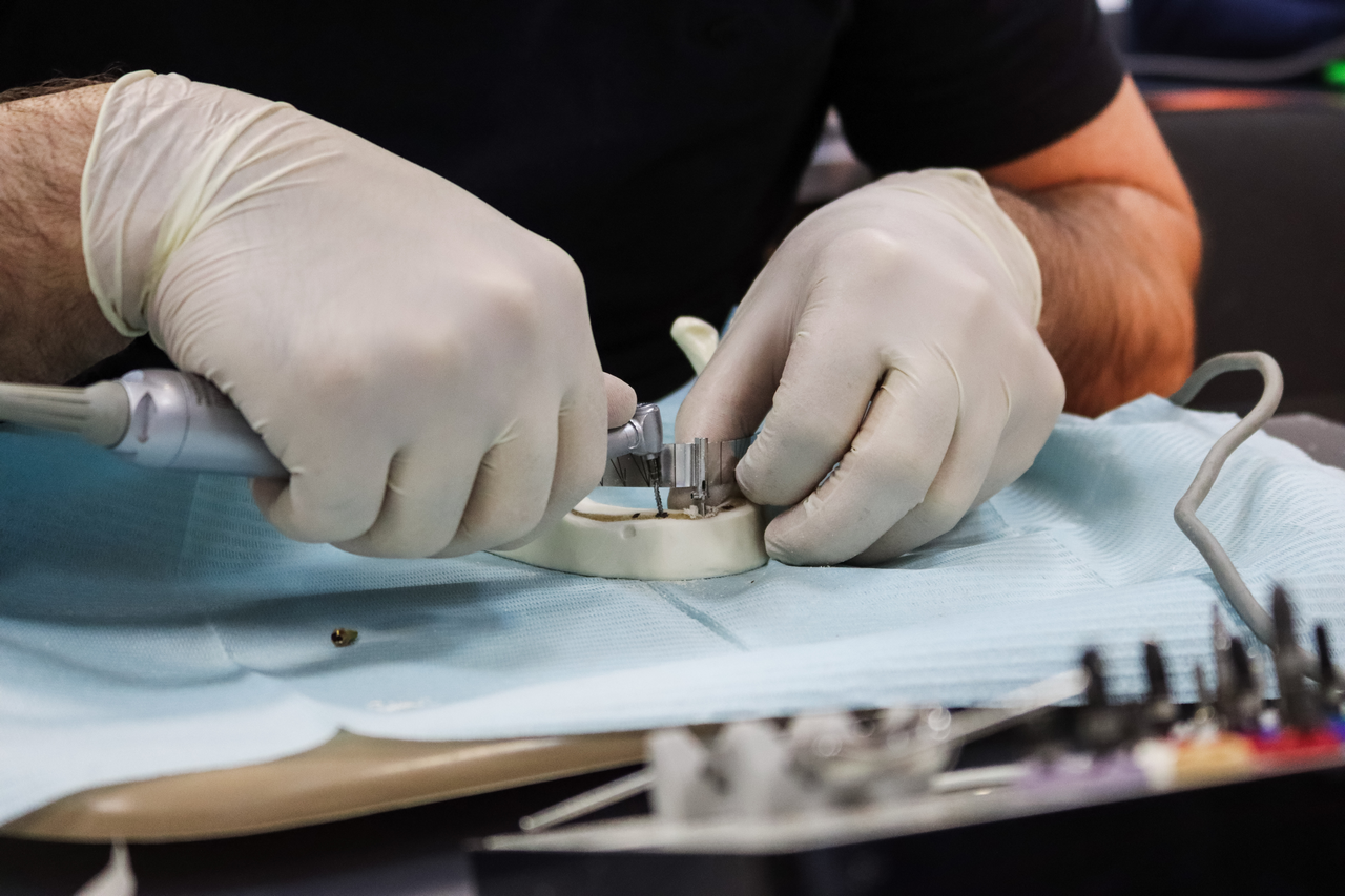 Стоматологическая реабилитация с помощью ангулированных имплантатов, 25.02.2022