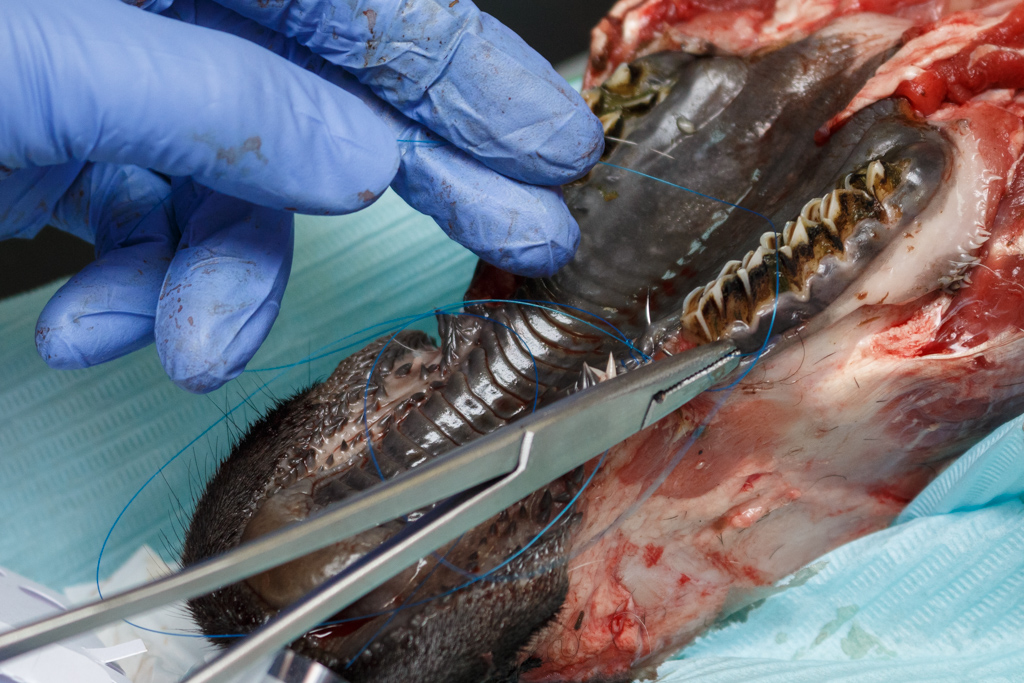 Атравматичное удаление зубов и методики наложения швов