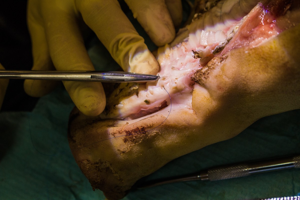 Пластика мягких тканей вокруг имплантатов. Морфологический подход - курс Виталия Панцулаи в УЦ Дентал Гуру.