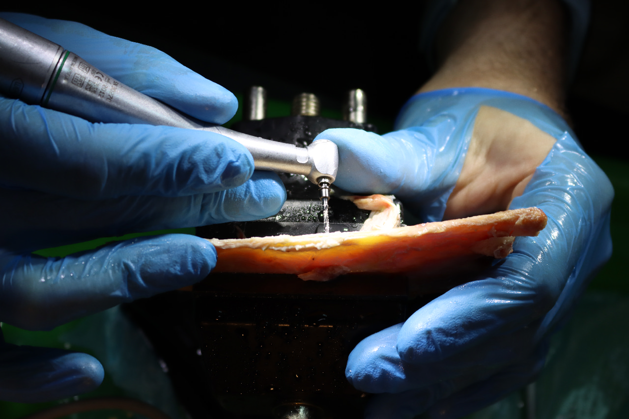 Продвинутый курс по имплантации: костная пластика и синус-лифтинг