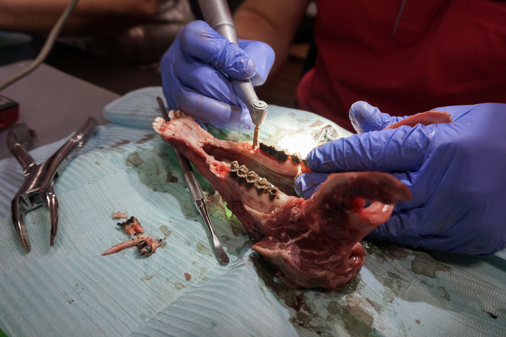 Одномоментная имплантация и немедленная нагрузка