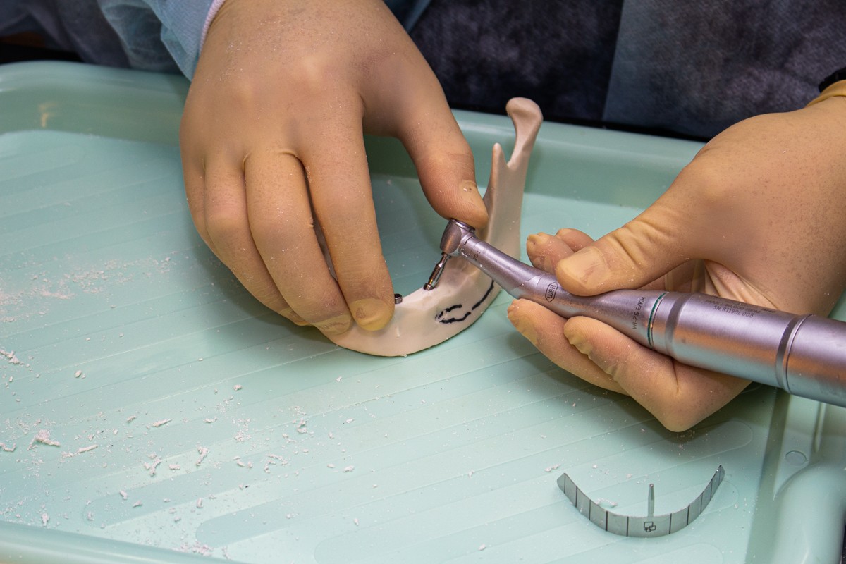 Стоматологическая реабилитация с помощью ангулированных имплантатов. 5 февраля 2020, Данилов Александр Алексеевич