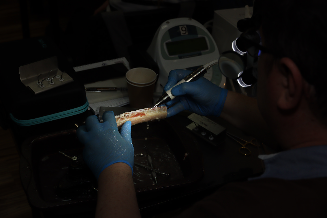 Продвинутый курс по имплантации: костная пластика и синус-лифтинг