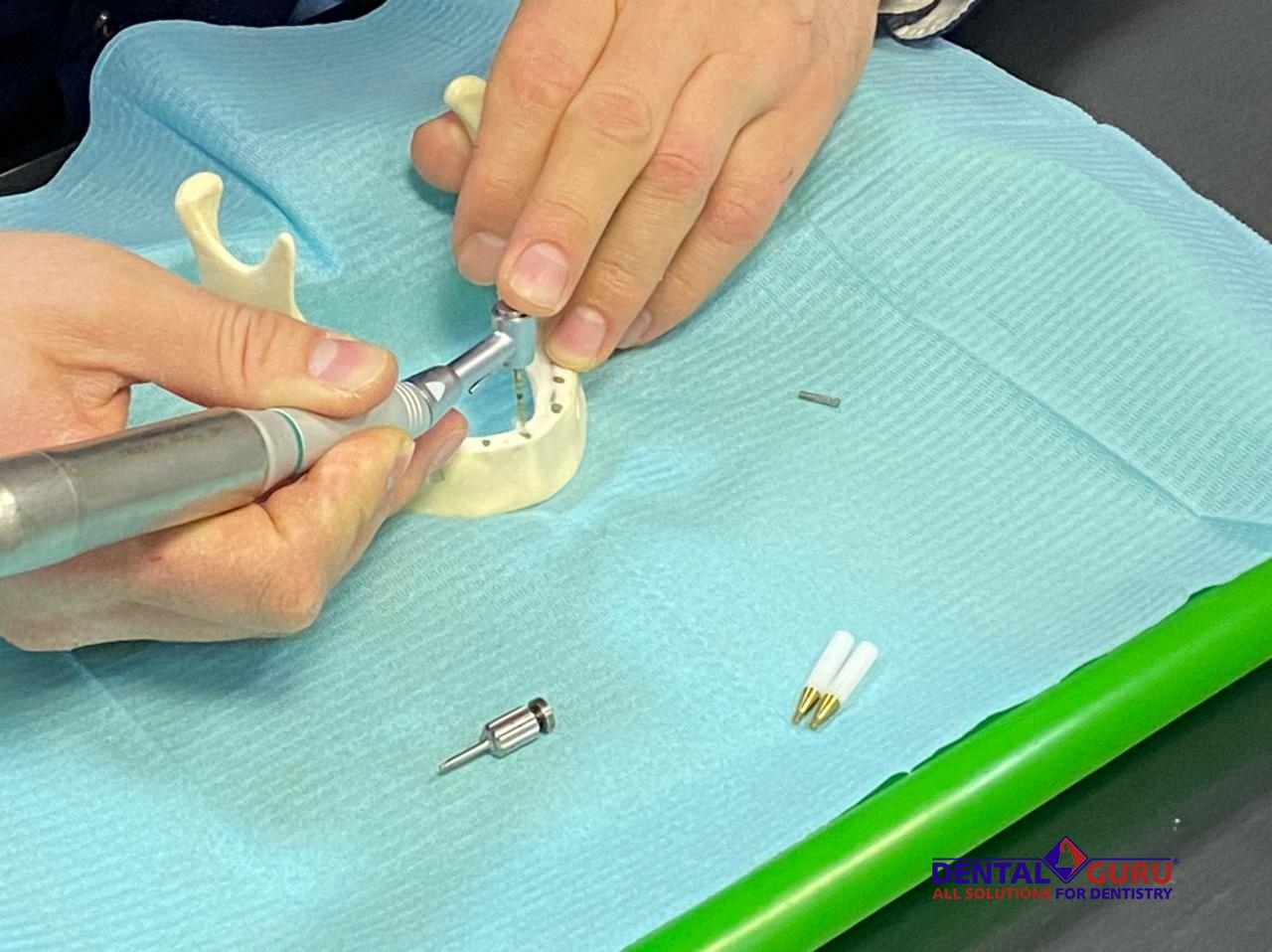 «Стоматологическая реабилитация с помощью ангулированных имплантатов. Имплантация на 4-х имплантатах. Физиологическое и анатомическое обоснование». Пост-релиз 31.01.21