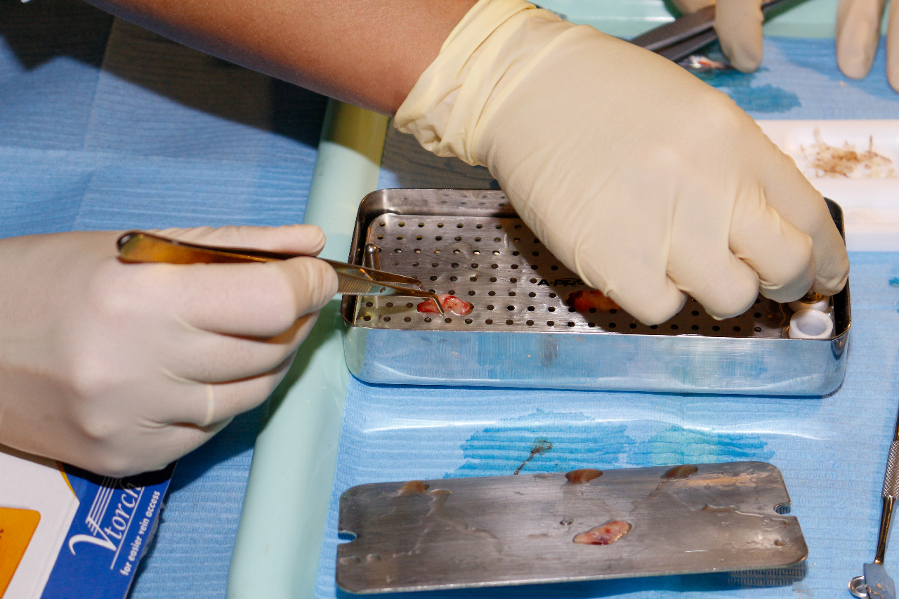 Плазмотерапия PRF в стоматологии 29.09.23