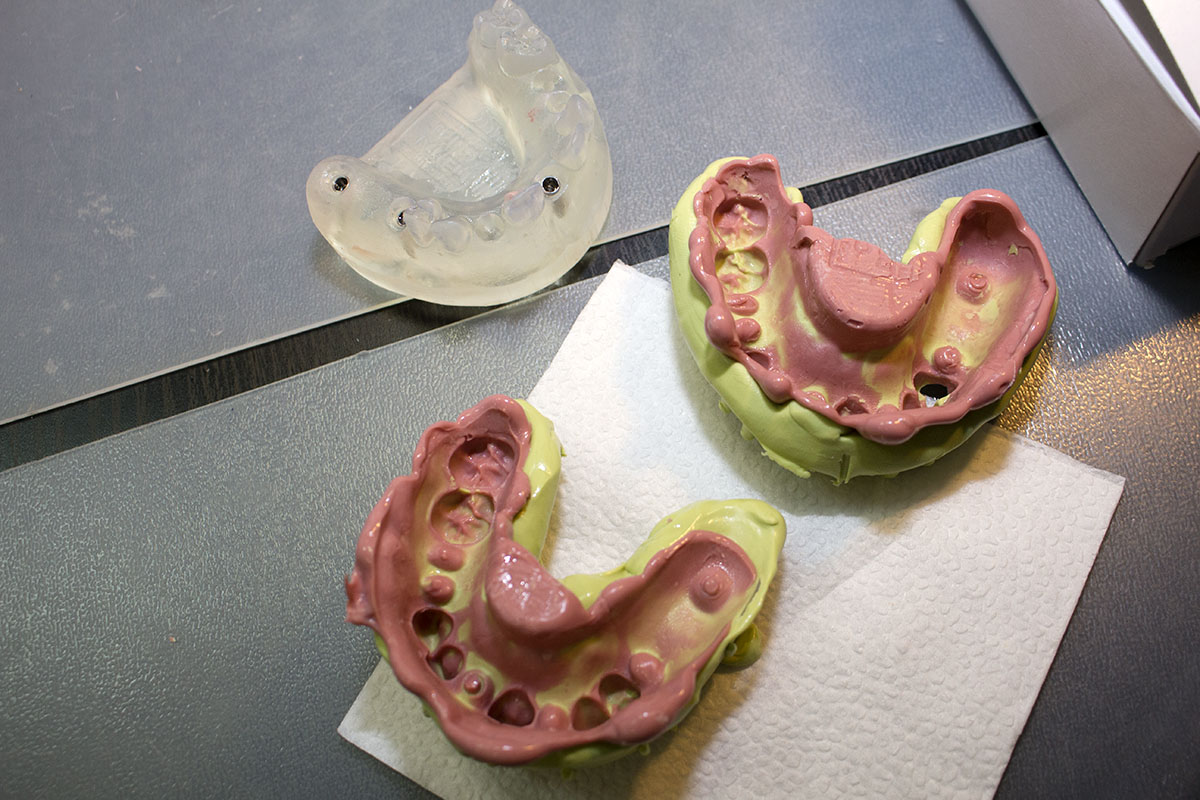 Современные методики снятия слепков. Расширенный курс Акмала Карабаева 28 февраля 2020г.