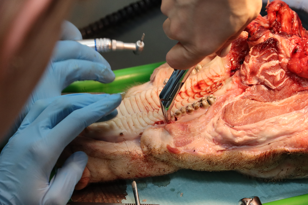 Атравматичное удаление зубов и методики наложения швов