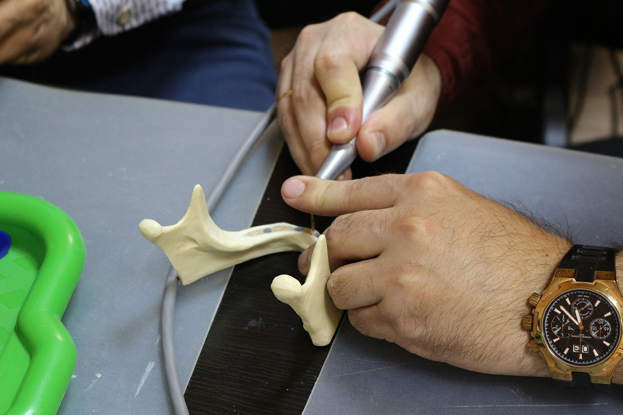 Стоматологическая реабилитация с помощью ангулированных имплантатов. Пост-релиз 4 декабря