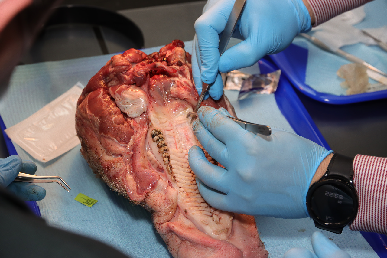 Пластика мягких тканей вокруг имплантатов. Морфологический подход