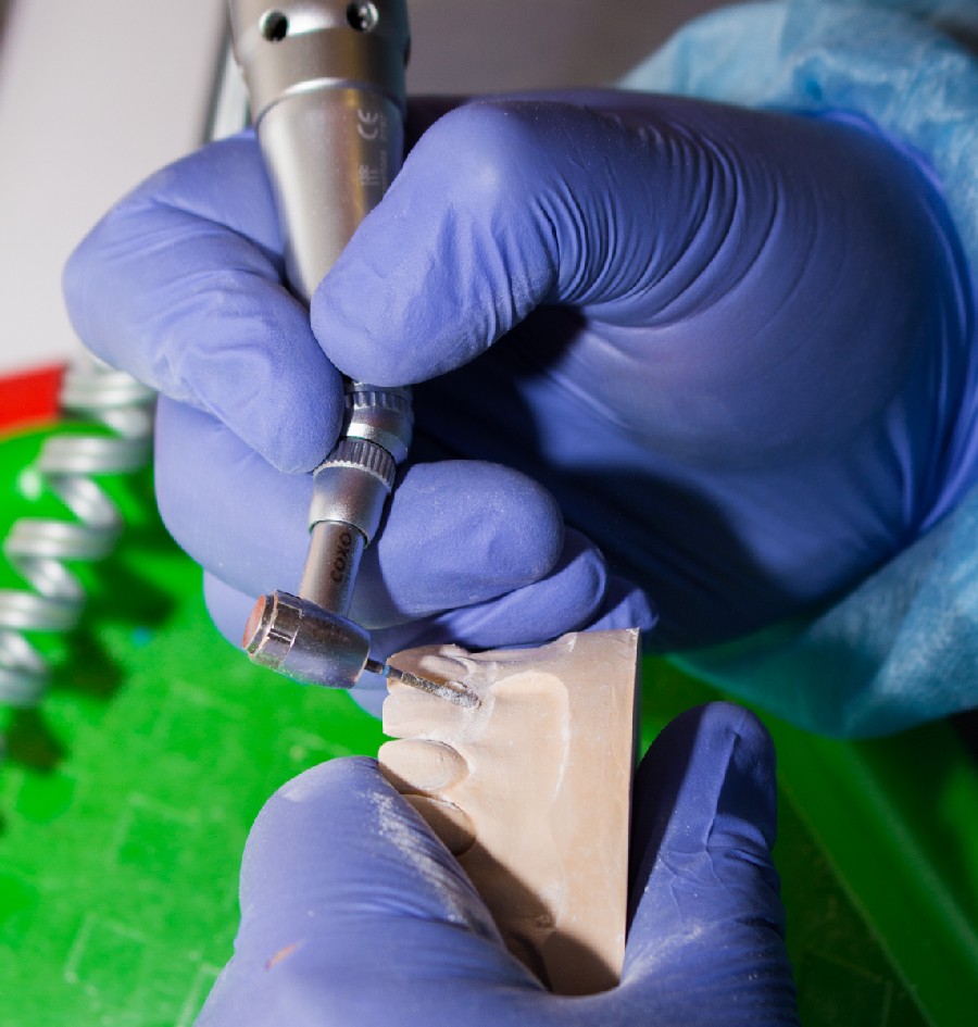 Препарирование зубов под цельнокерамические реставрации во фронтальном отделе, 26 февраля 2020г.