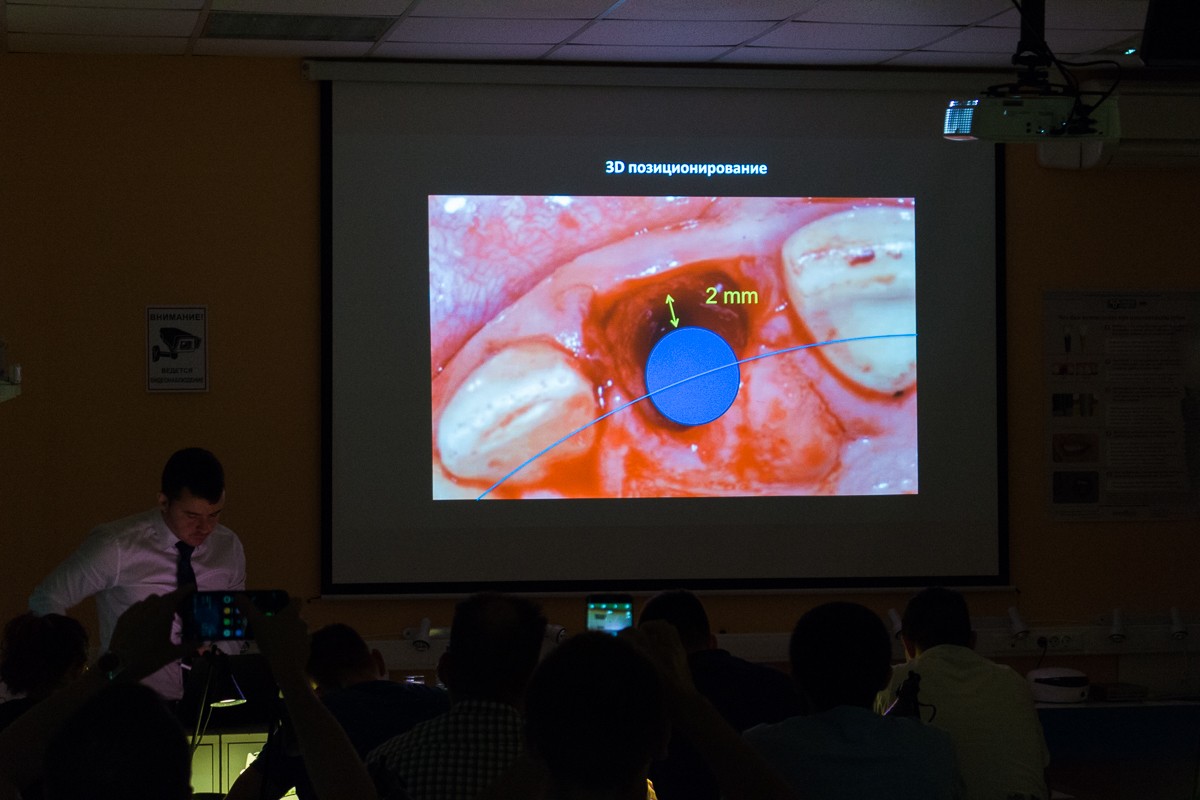 Одномоментная имплантация и немедленная нагрузка