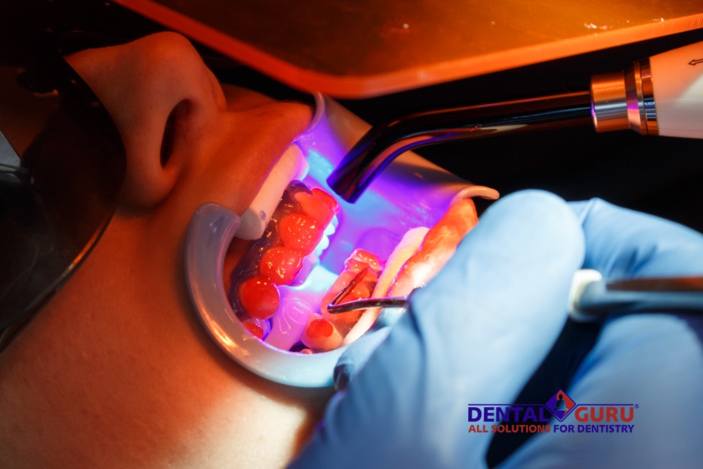 Первый московский чемпионат по отбеливанию в клинике «Дентал Гуру»