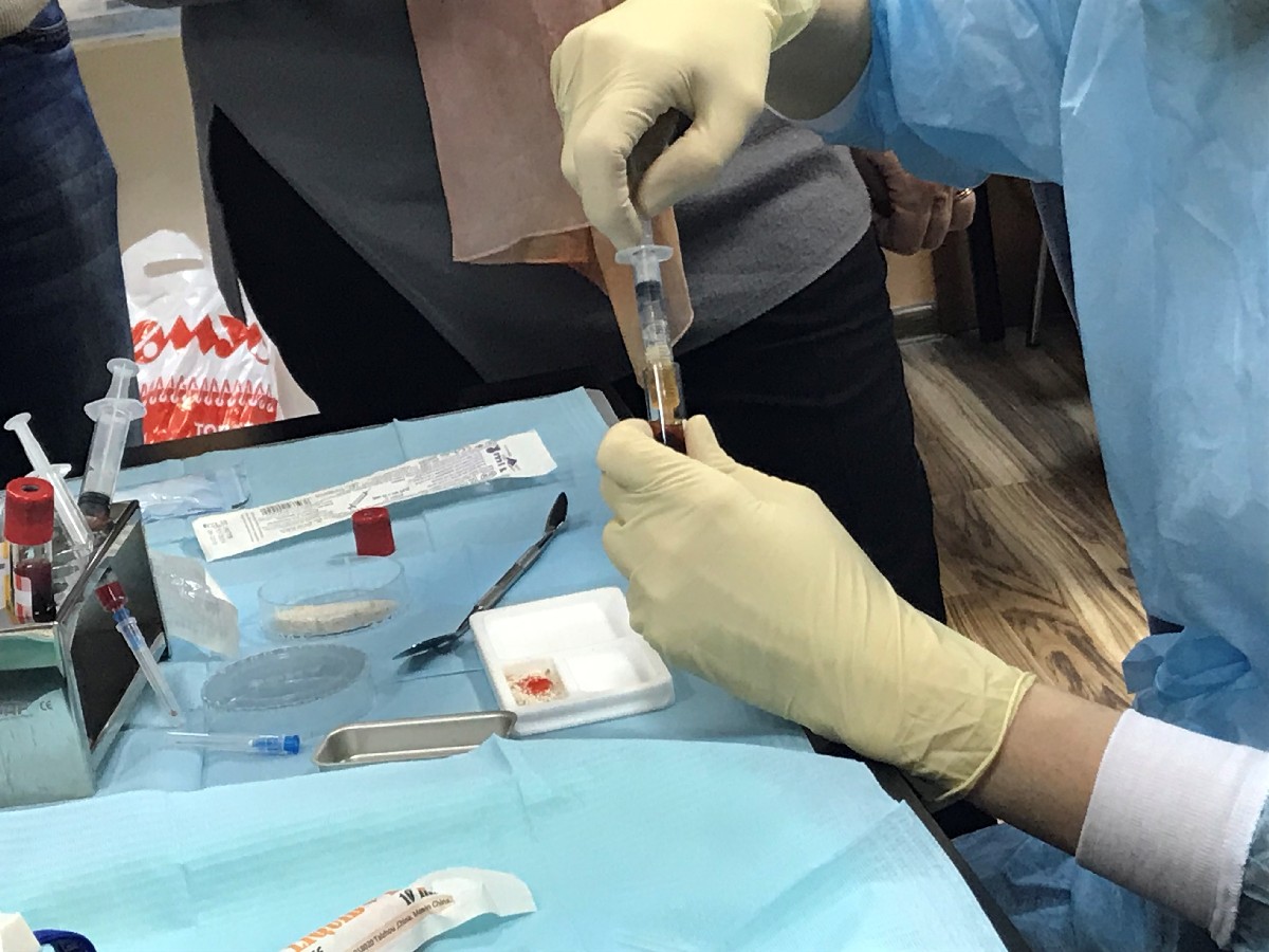 Плазмотерапия PRF в стоматологии. 9 февраля 2020. Сечко Нина Андреевна