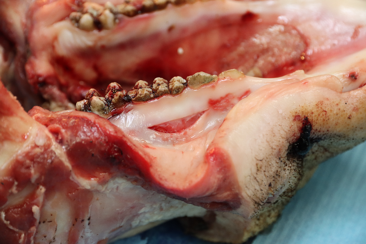 Продвинутый курс по пластике мягких тканей