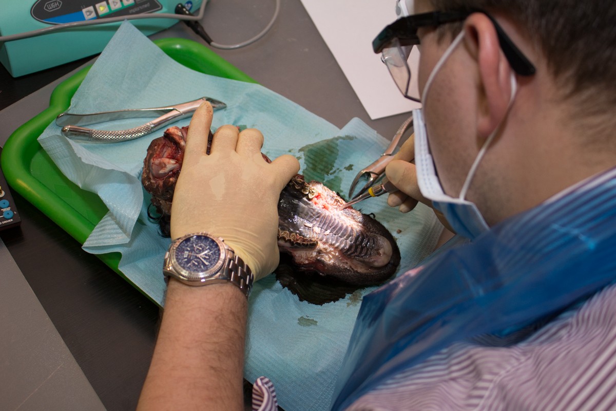 Одномоментная имплантация и немедленная нагрузка. 3 февраля 2020