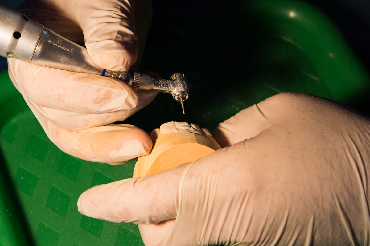 Препарирование зубов под цельнокерамические реставрации во фронтальном отделе. 3 сентября 2019, Султанов К.С.