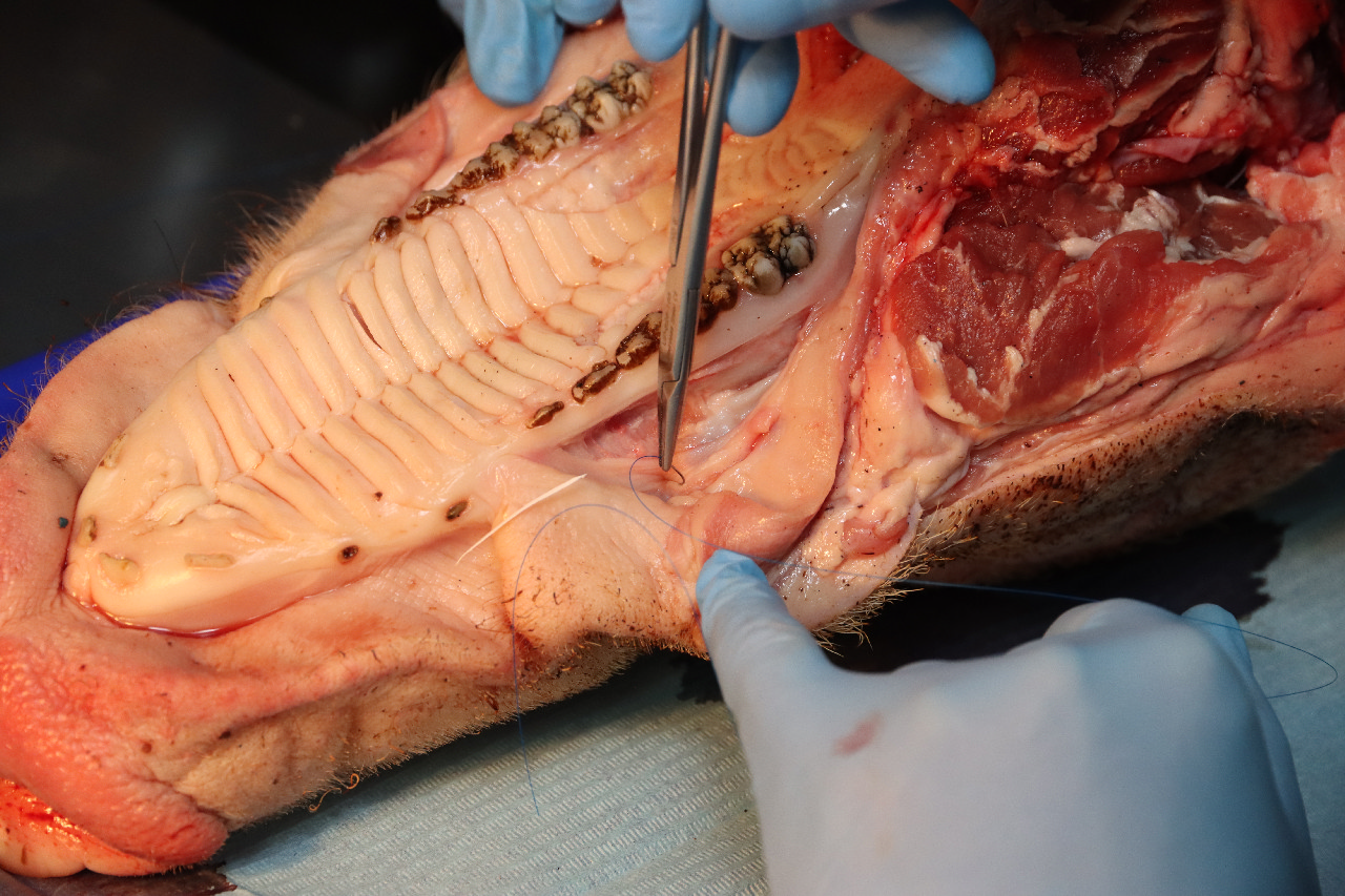 Пластика мягких тканей вокруг имплантатов. Морфологический подход