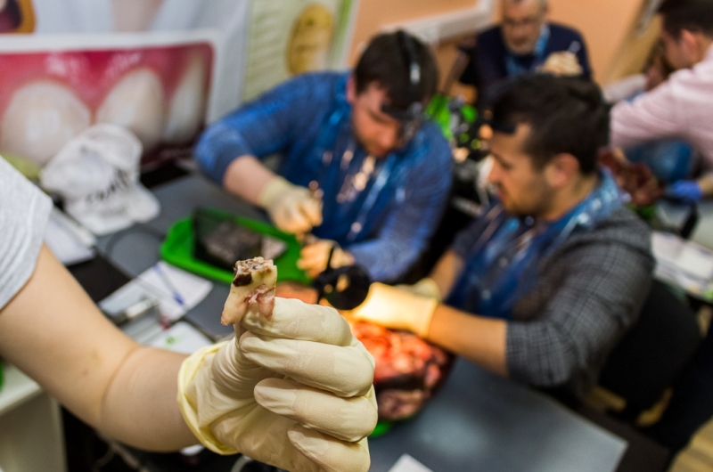 Одномоментная имплантация и немедленная нагрузка