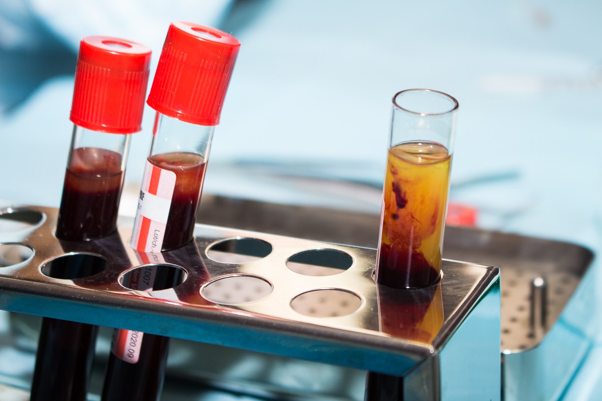 Применение факторов роста (IPRF, APRF) в стоматологии. 20 сентября 2019. Сечко Нина Андреевна