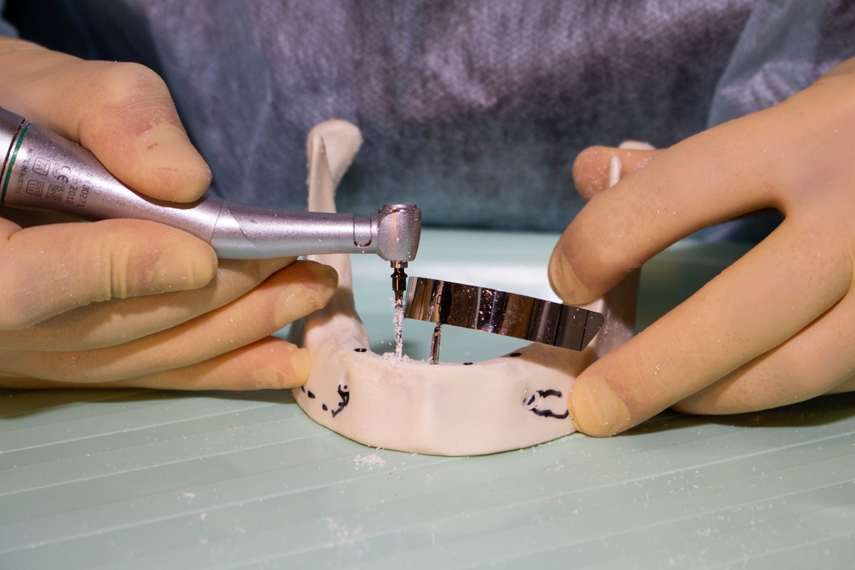 Стоматологическая реабилитация с помощью ангулированных имплантатов. 5 февраля 2020, Данилов Александр Алексеевич