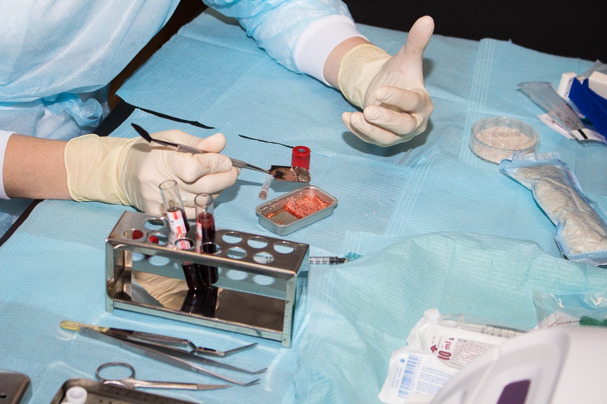 Применение факторов роста (IPRF, APRF) в стоматологии. 20 сентября 2019. Сечко Нина Андреевна