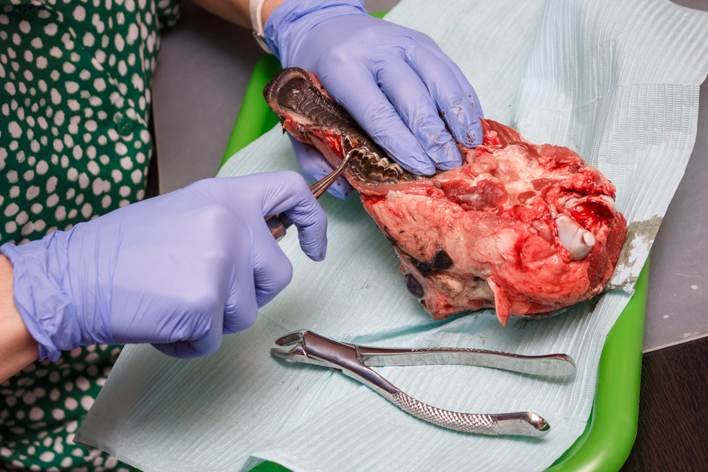 Атравматичное удаление зубов и методики наложения швов