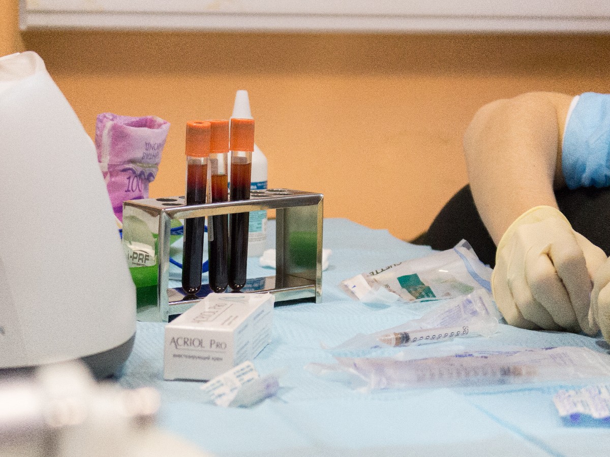 Применение плазмы с высоким содержанием фибрина (IPRF) в эстетической медицине