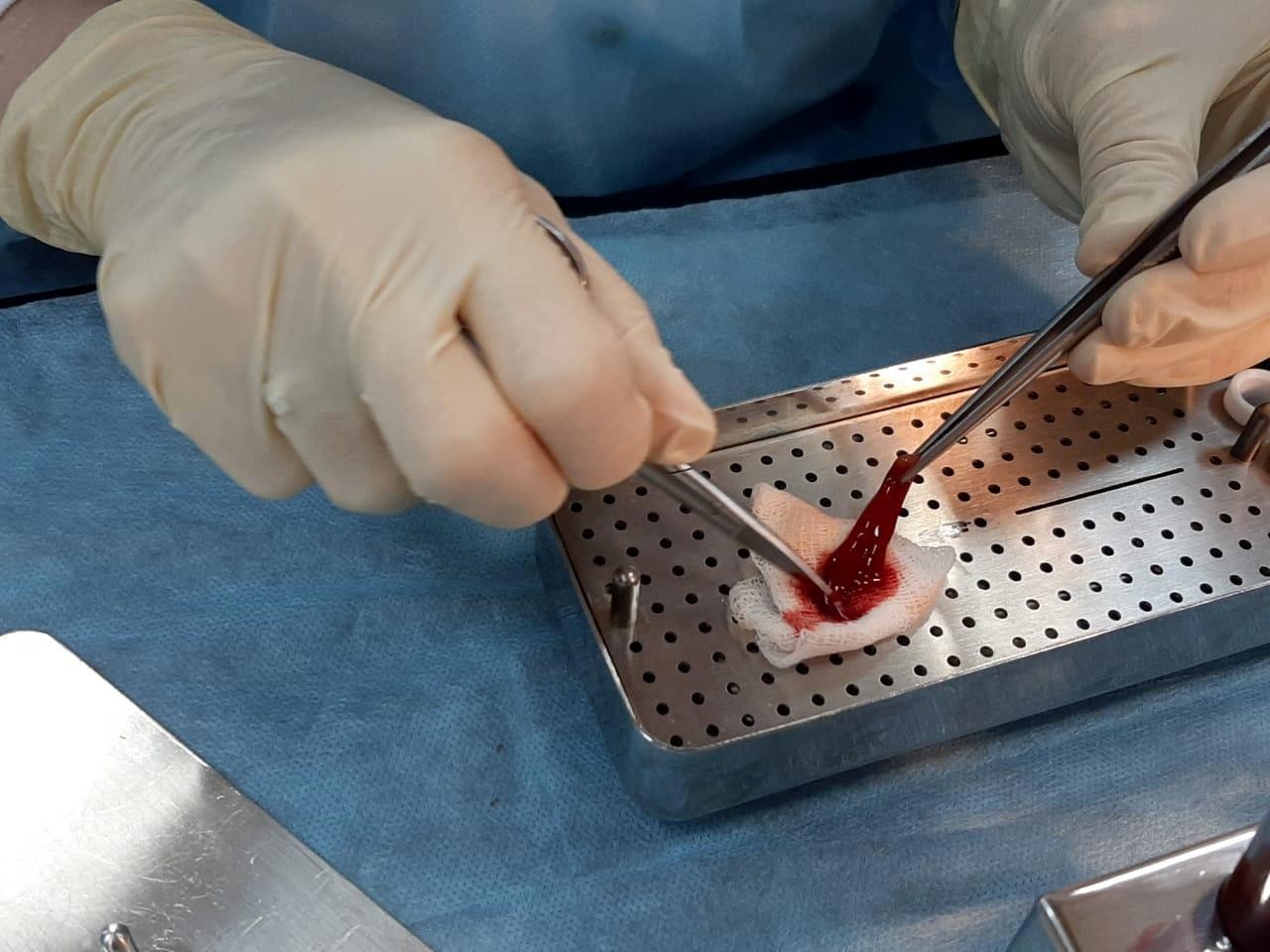 Плазмотерапия PRF в стоматологии. Курс в УЦ Дентал Гуру 3 сентября.