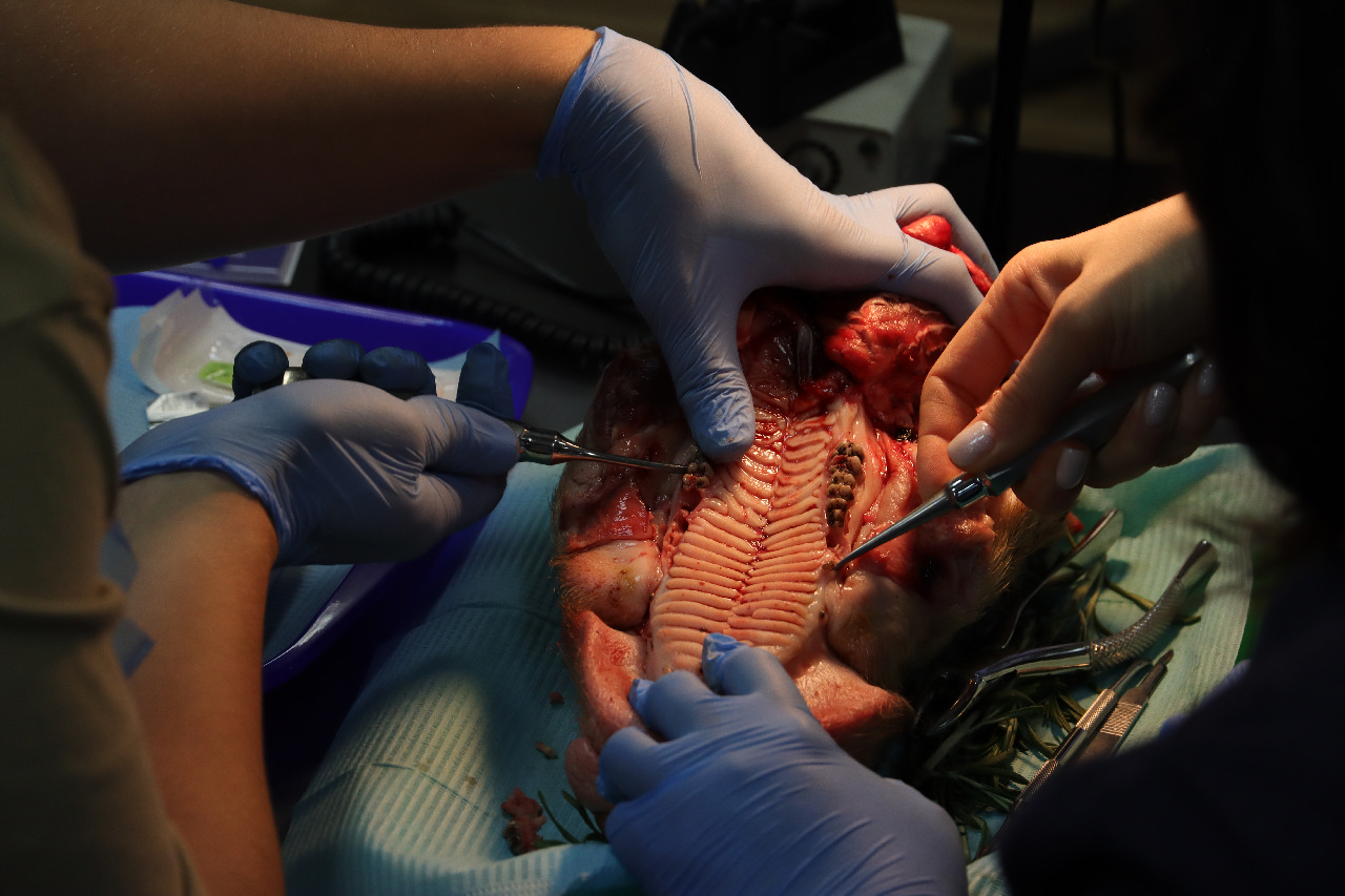 Атравматичное удаление зубов и методики наложения швов