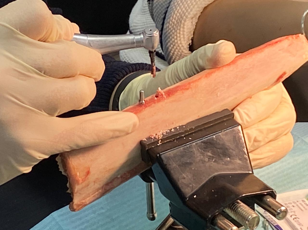 Фундаментальный курс по имплантации. Пост-релиз 13 марта