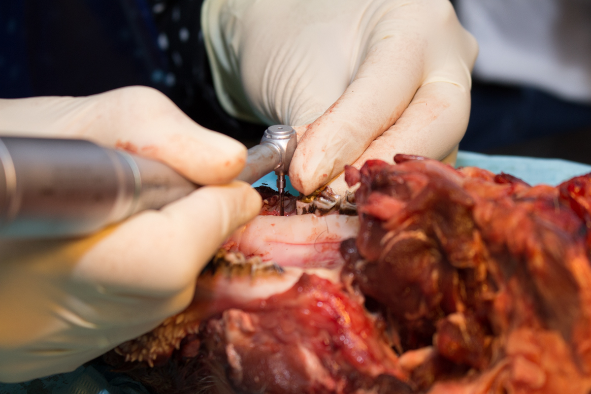 Одномоментная имплантация и немедленная нагрузка. 3 февраля 2020