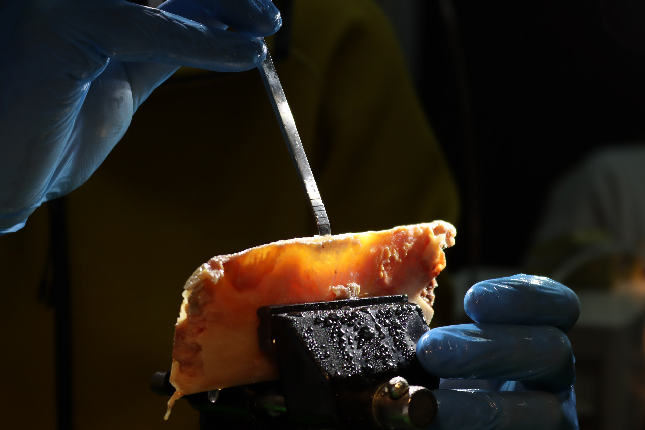 Продвинутый курс по имплантации: костная пластика и синус-лифтинг