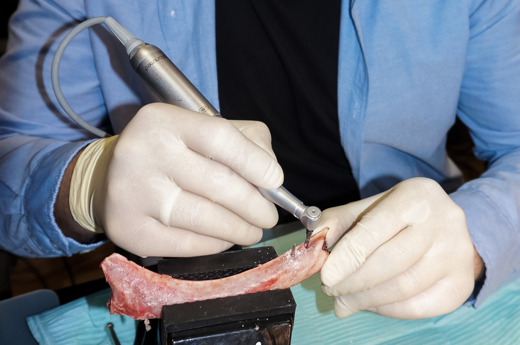 Базовый курс по имплантации